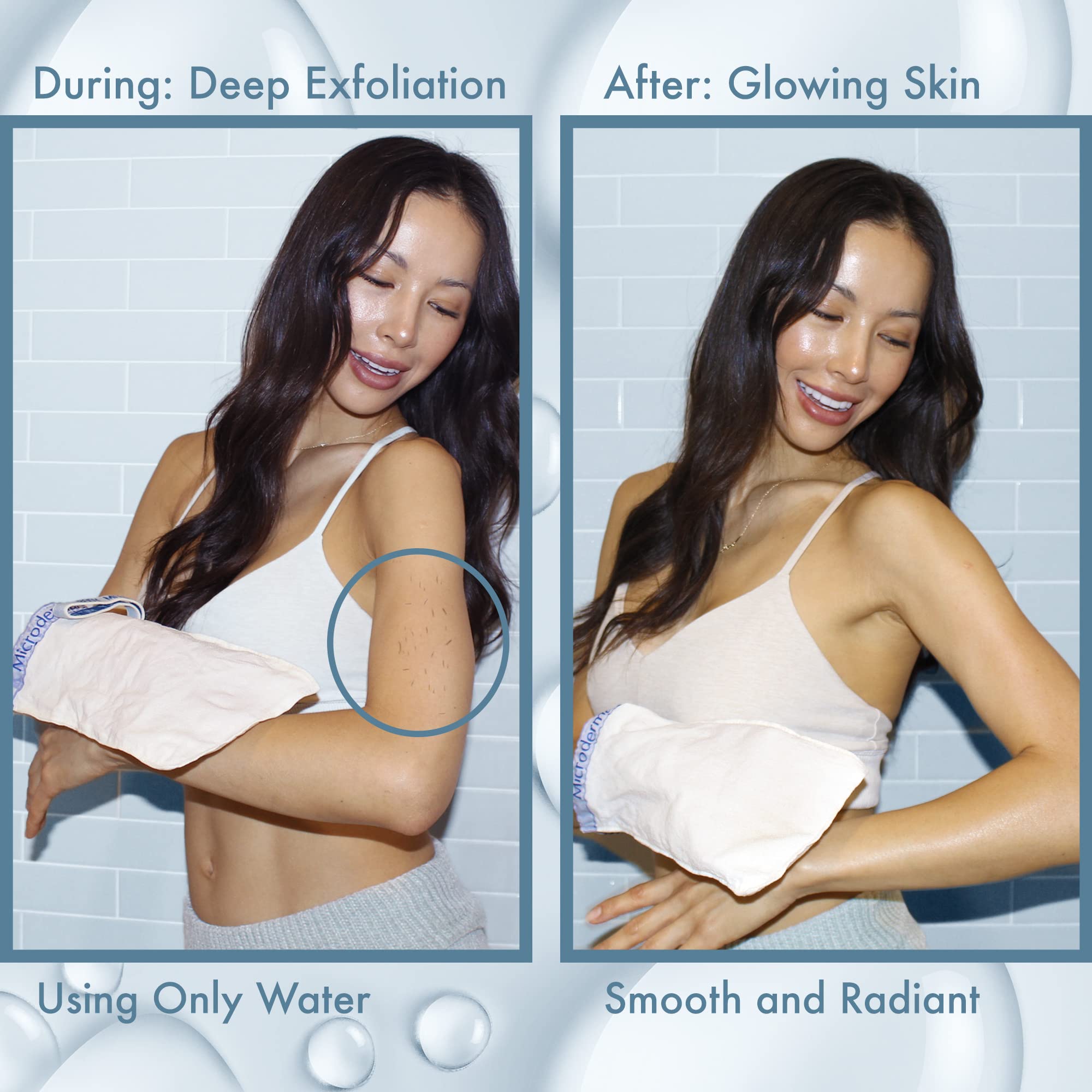 MicrodermaMitt Deep Exfoliating Mitt for Shower – Dead Skin Remover & Exfoliator Body Scrubber - Keratosis Pilaris – Premium Quality for Smooth & Cleaner Skin Quickly - Feels Good on Skin - No Dyes