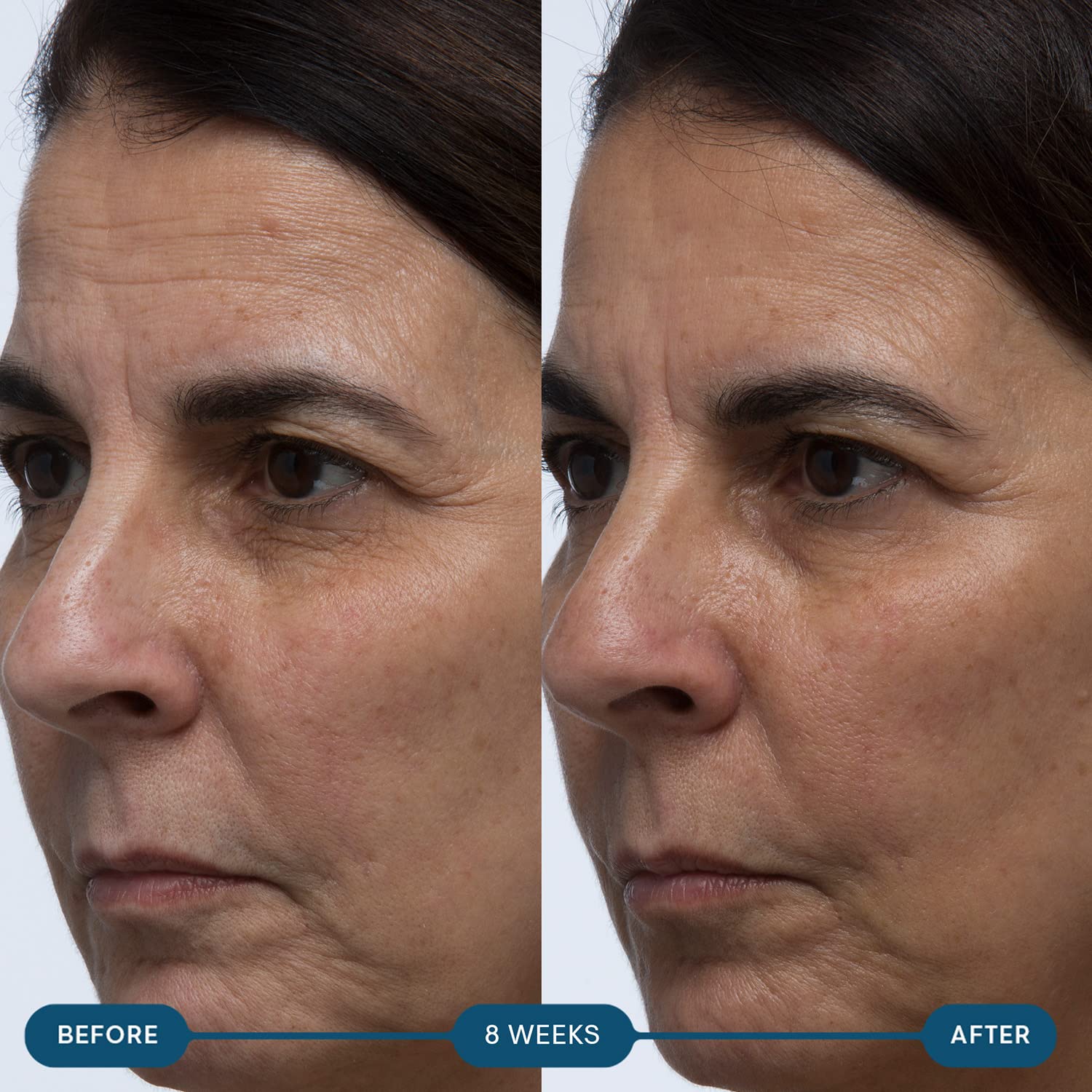 ELEMIS Pro-Collagen Skin Future Supplements, Daily Ingestible Reduces the Look of Fine Lines & Wrinkles, Supports Hydration & Elasticity, 60 Capsules