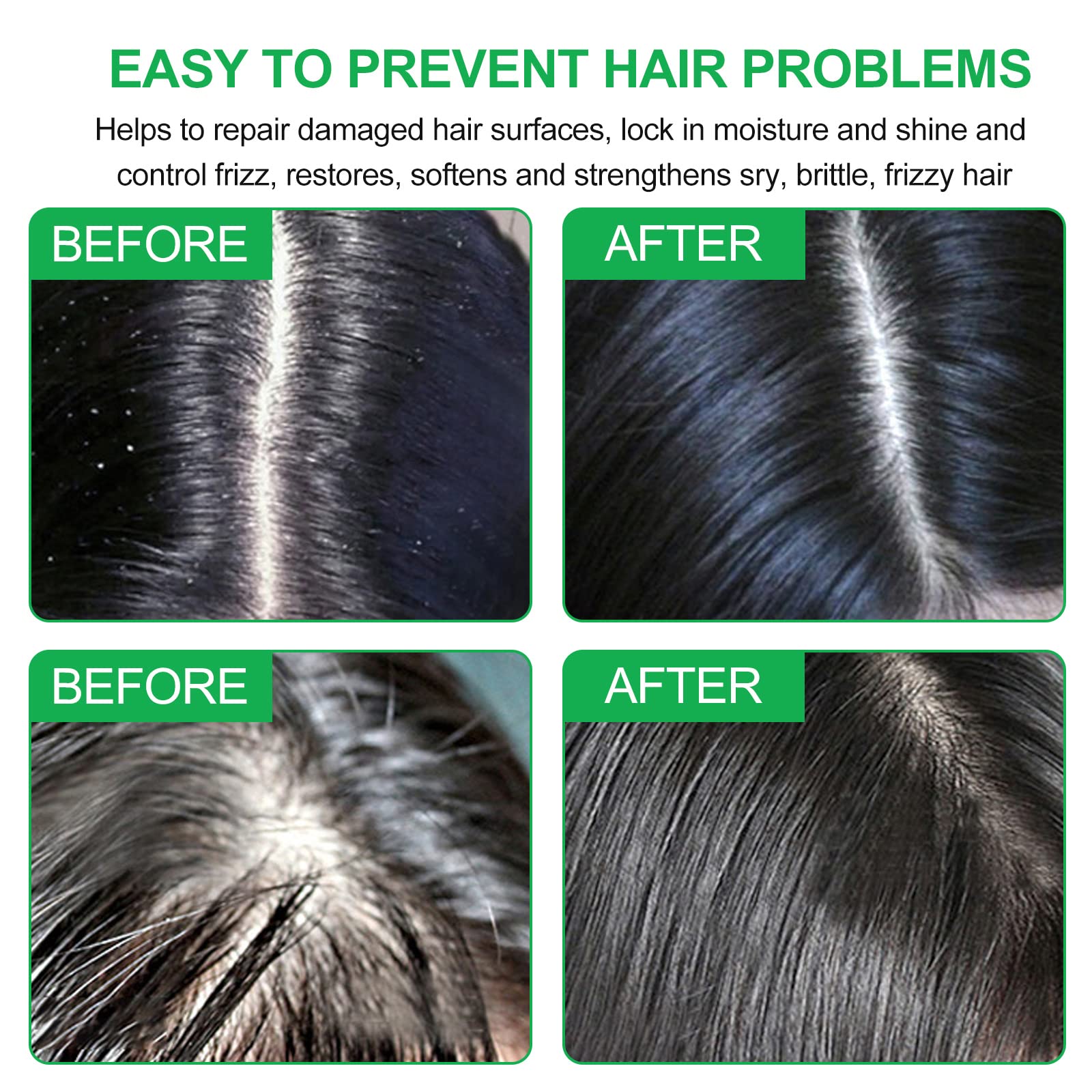 Rosemary Shampoo Bar for Hair Growth and Deep Cleansing - Solid Soap, Anti Hair Loss, Gift for All Hair Types (Rosemary-1.92oz)