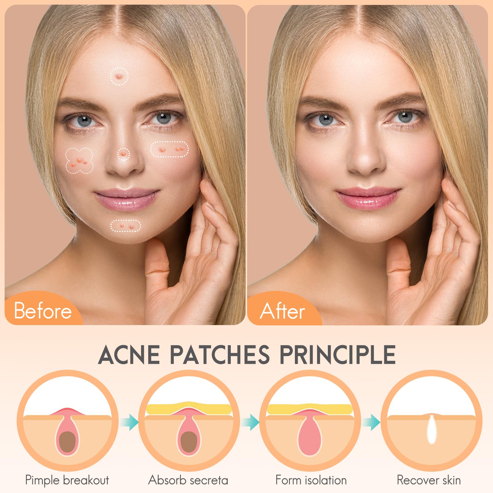AOAWI Acne hydrocolloid Patches, 5 sizes and 4 shapes with 186pcs, The innovative size L suitable face, body, nose, Pimple, Acne blemishes, with Salicylic Acid, Tea Tree Oil,Centella Asiatica