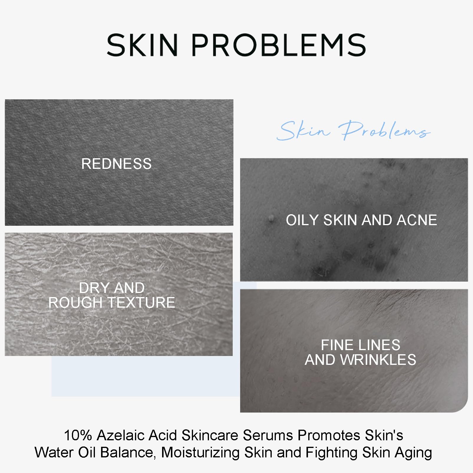 Azelaic Acid Serum, Azelaic Acid 10% Facial Serum, Skin Hyaluronic Acid Serum for Face, Redness-Relief for Face, Redness Reducing Skin Care, Balance Excess Sebum, 0.5oz