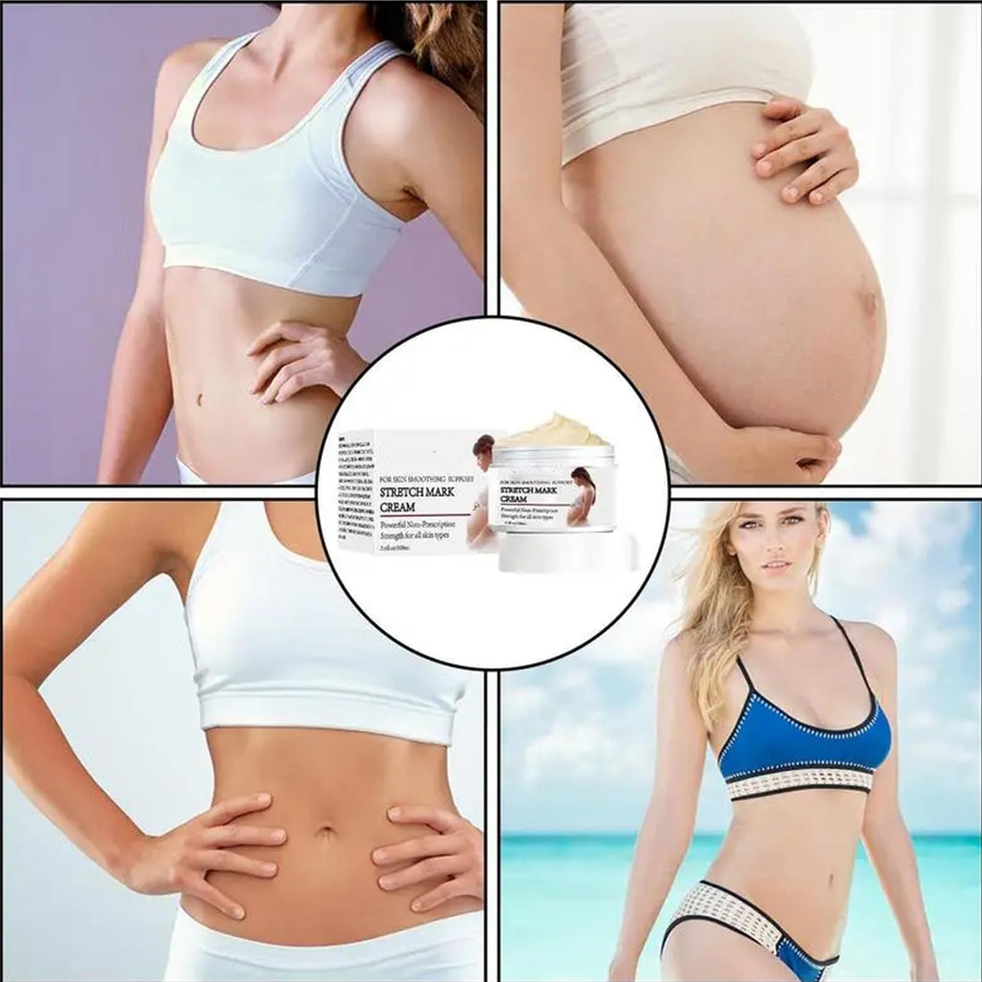 Rosarden Stretch Mark Prevention Cream for Pregnancy, Stretch Mark Cream Remover, Stretch Mark Lotion for Pregnancy, Tummy Butter for Stretch Marks Pregnancy, Shea Butter Stretch Mark Removal Cream