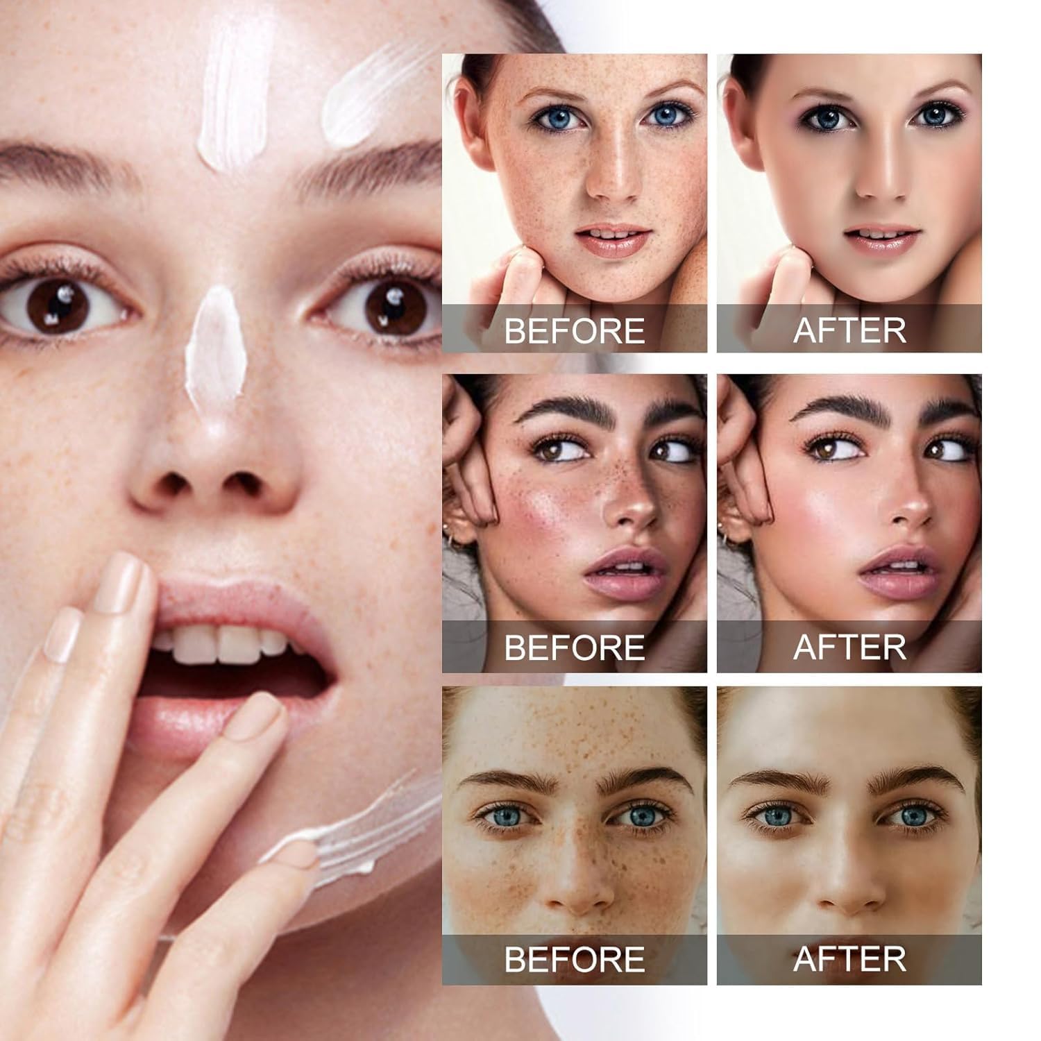 Crema para Manchas Oscuras en La Cara, Cremas para Quitar Manchas de La Cara, Crema Blanqueadora para Pecas, Elimina el Melasma Manchas Oscuras Aclara La Piel, 20g/0.71oz (2 PCS)