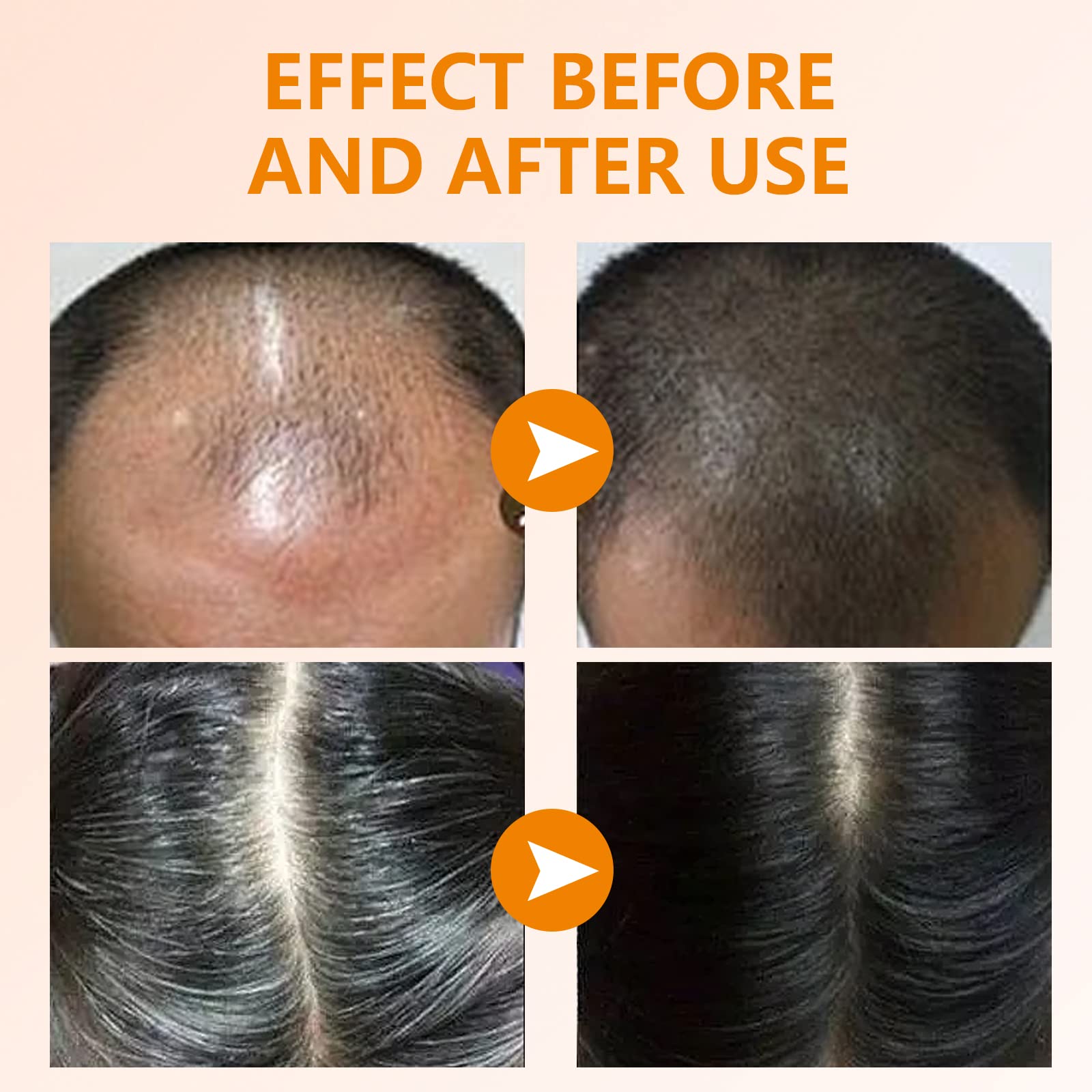 2 Pack Ginger Hair Regrowth Shampoo Bar Turmeric Soap for Hair Growth Natural Ginger Solid Bars for Thinning Strengthen Curly Oily Hair Anti Hair Loss Travel Deep Cleansing Women Men 4.23OZ/120g