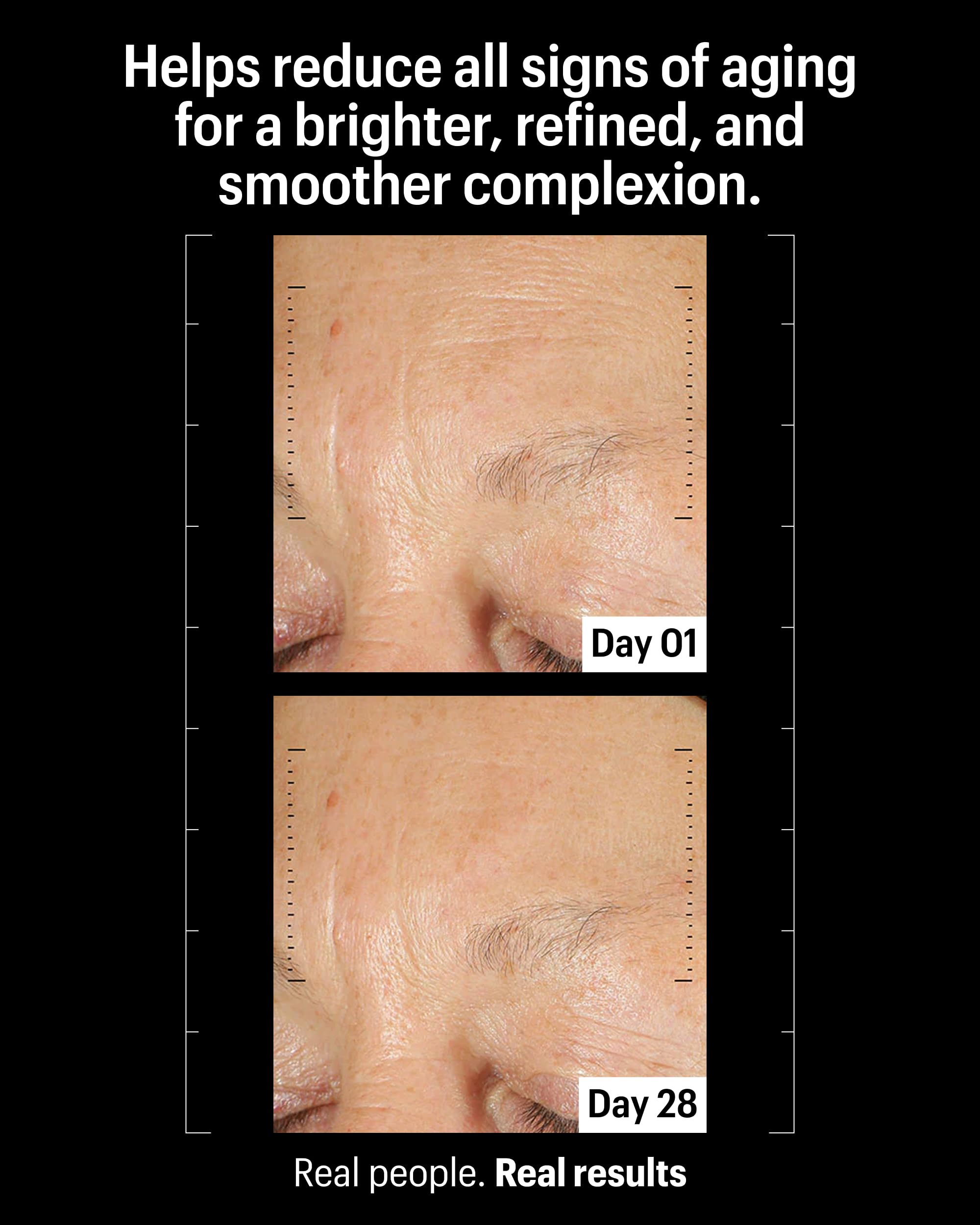 Allies of Skin Retinal 0.1% Peptides Repair Night Cream with 0.1% Encapsulated Retinal, 6 Peptides, 2% Ornithine & EGCG Complex, 8.7% Ceramides & Omegas Complex
