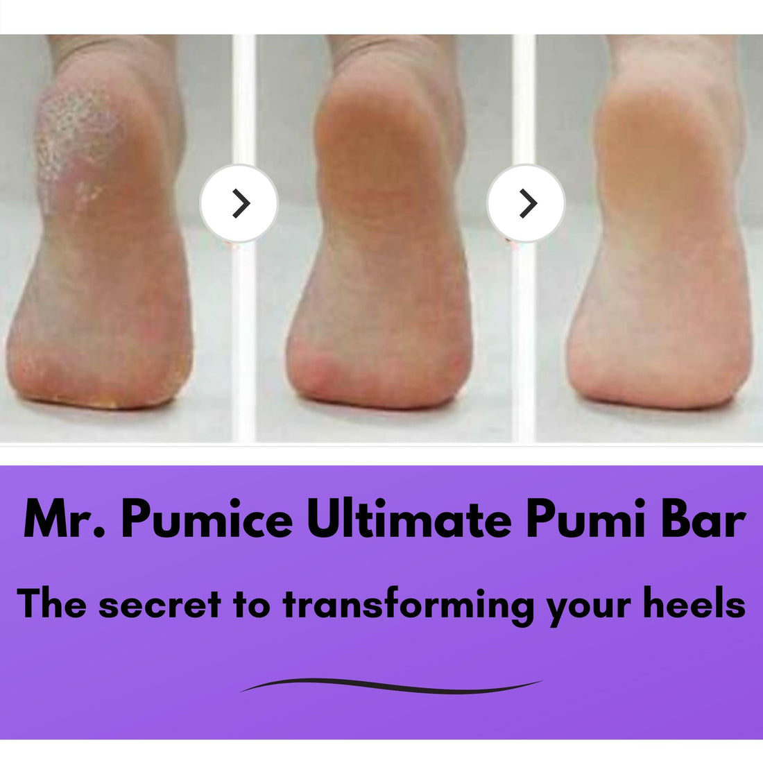 Mr. Pumice Ultimate Pumi Bar 2 in 1 (Coarse/Medium), Lavender/Purple, 1 piece