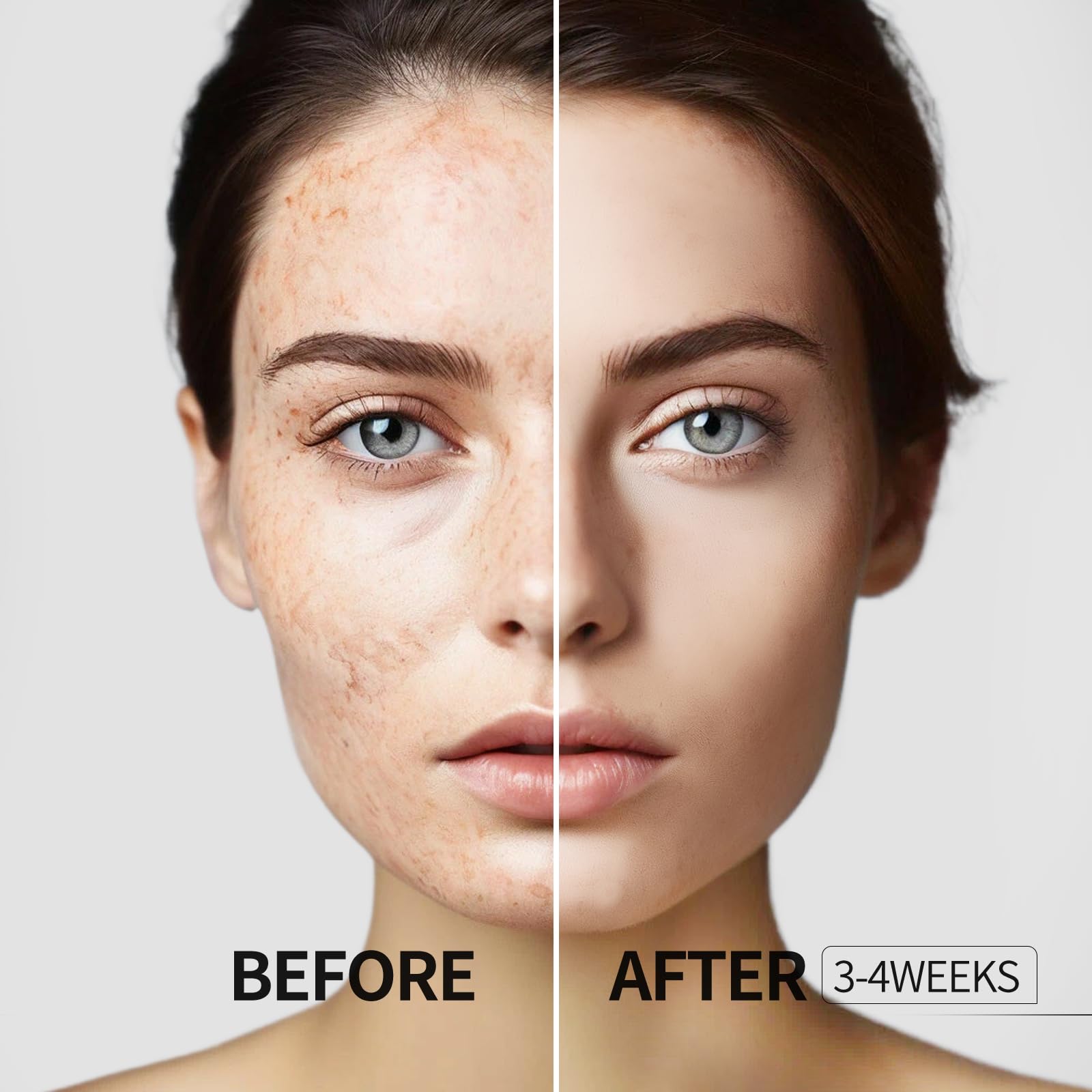 HANYWIL Dark Spot Remover for Face and Body, Dark Spot Corrector Serum, Age Spot Sun Spot Freckles Brown Spot Remover, Melasma Treatment for Face, Skin Care Face Serum with Roller (0.5 Fl Oz)