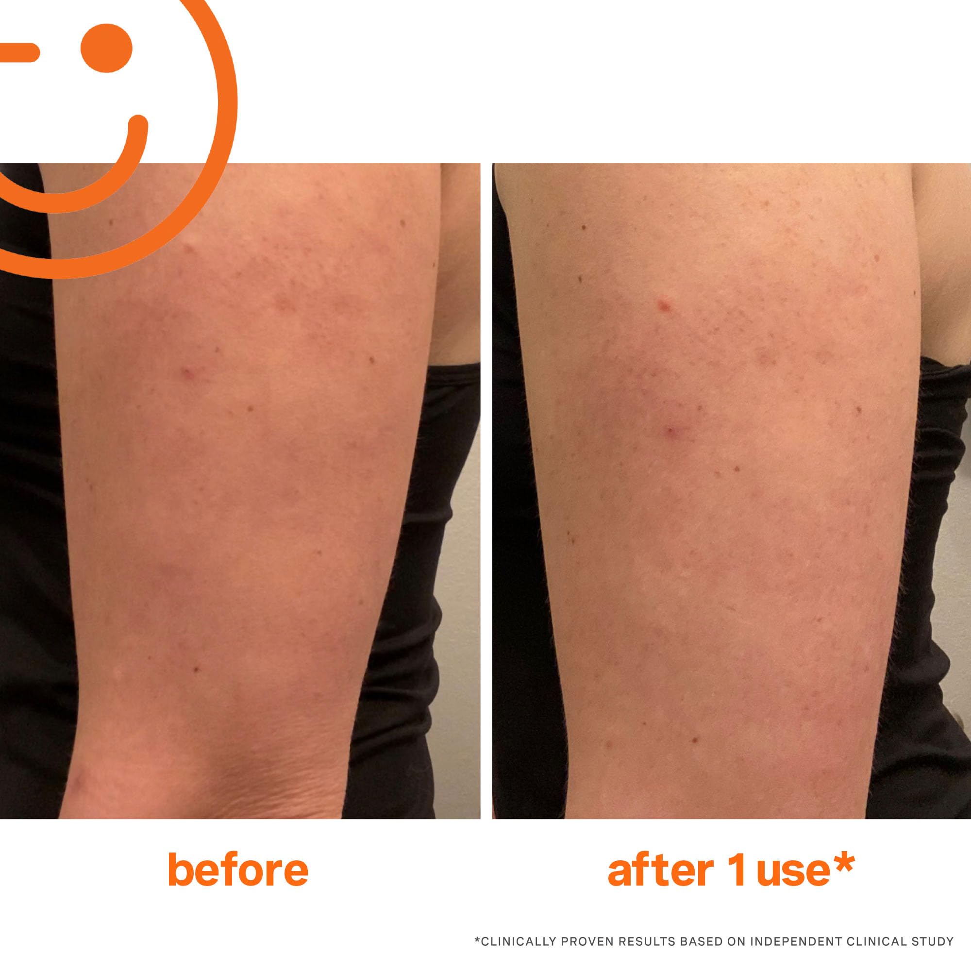 Kate Somerville ExfoliKate Resurfacing Body Scrub | Triple Action Exfoliating Body Polish | Removes Dead Skin | Improves Tone & Texture | 5 Fl Oz