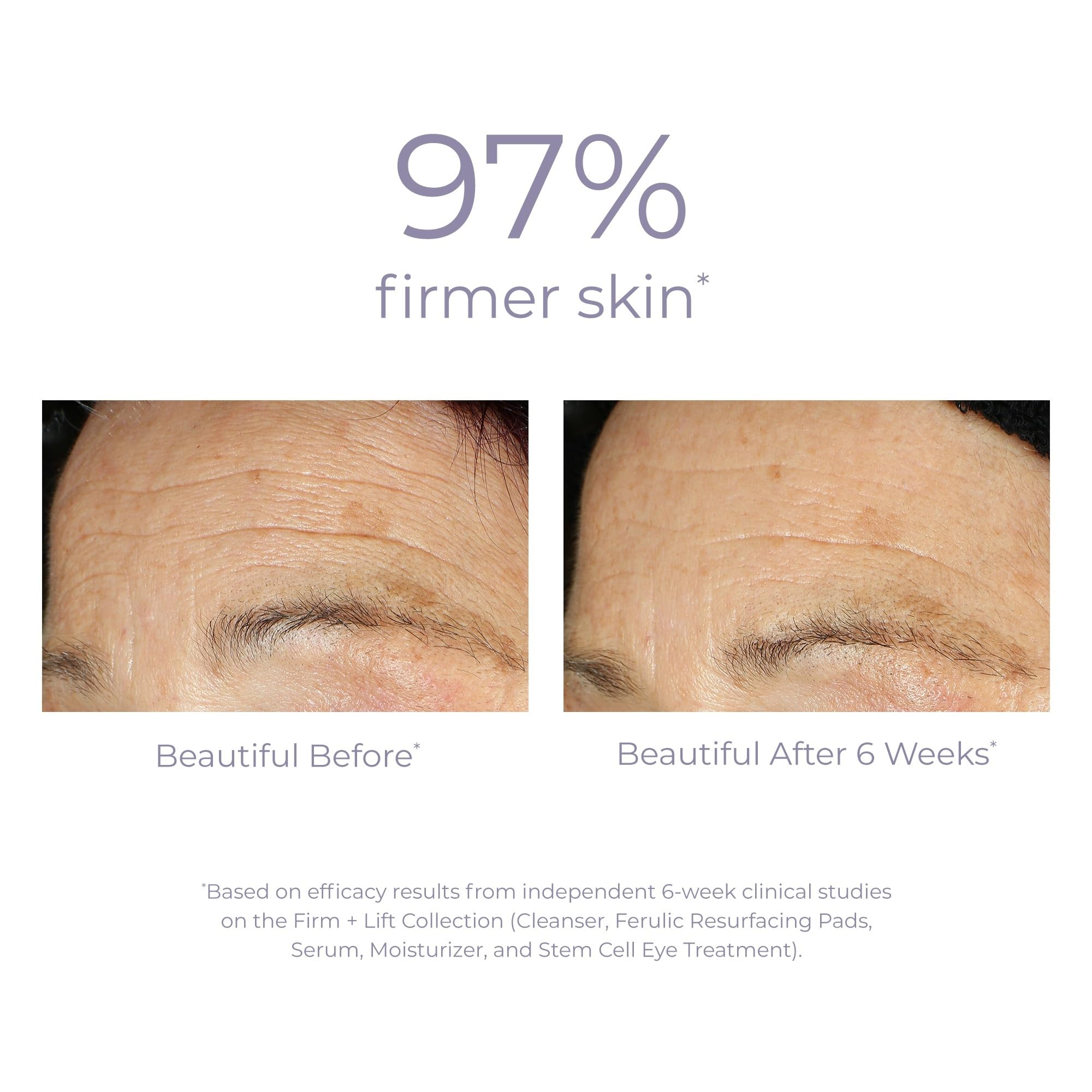 DERMA E Ultra Lift DMAE Concentrated Serum – All Natural Skin Firming & Hydrating Serum with Copper Peptides and Resveratrol – Concentrated Facial Skin Care, 1oz