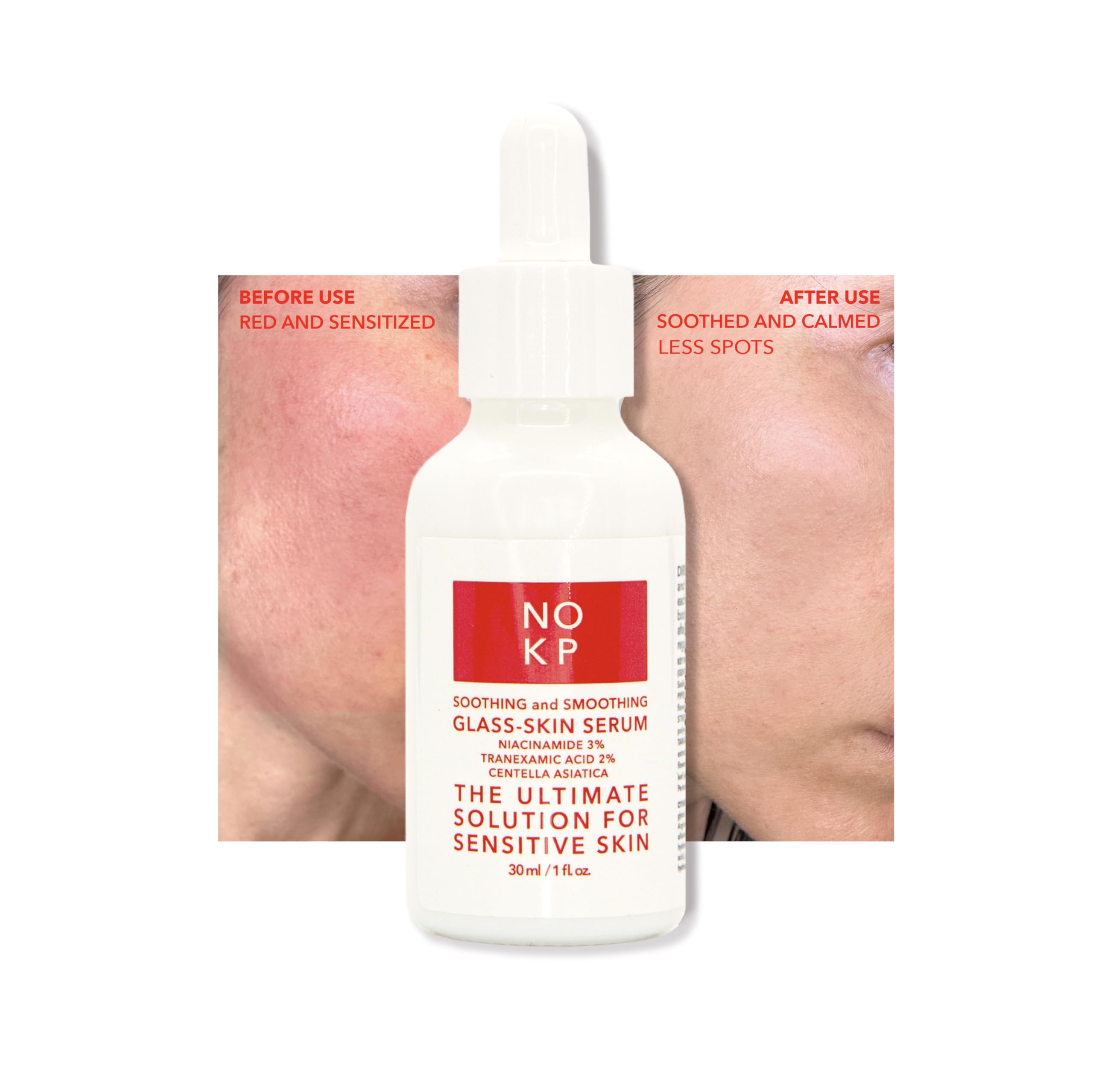 No KP Glass skin anti-redness soothing and smoothing serum for glowy skin, Calming Serum for Face and Body, Relieves skin redness and Rosacea with Centella Asiatica (Tiger grass), aloe, panthenol