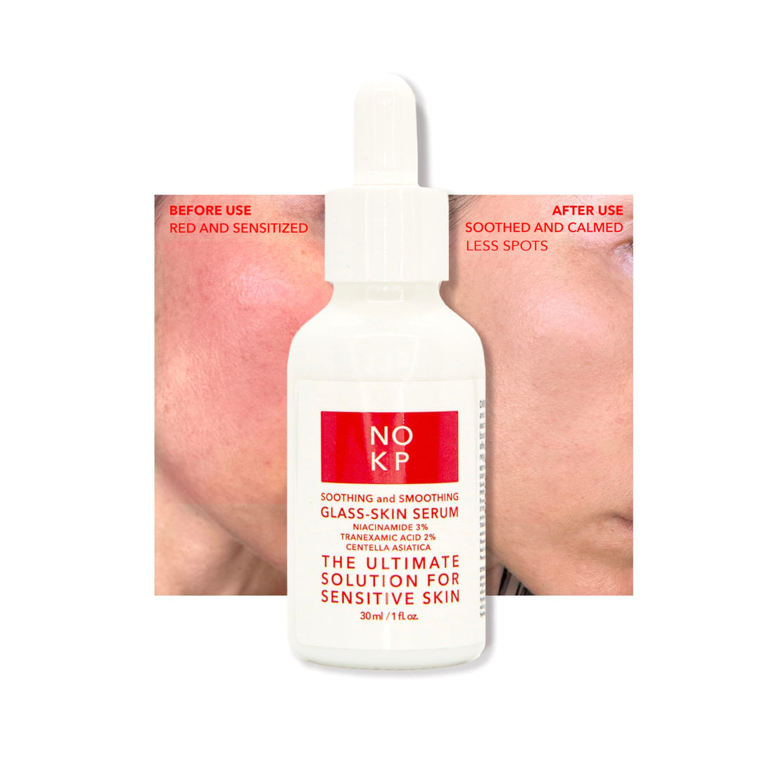 No KP Glass skin anti-redness soothing and smoothing serum for glowy skin, Calming Serum for Face and Body, Relieves skin redness and Rosacea with Centella Asiatica (Tiger grass), aloe, panthenol