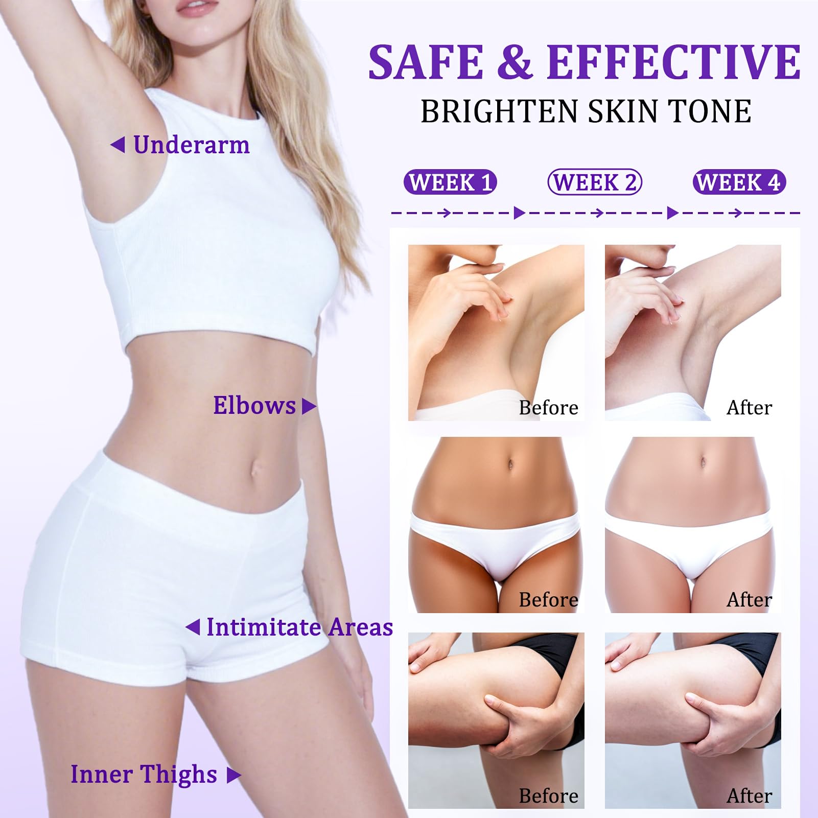 Dark Spot Remover for Body, Skin Bleaching Cream with Vitamin C for Intimate Areas, Skin Lightening Cream Dark Spot Corrector for Underarms, Knees, Elbows, Inner Thighs & Bikini Line,1.7fl oz