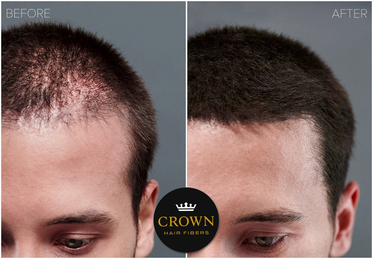 CROWN Hair Fibers - Best Keratin Hair Fibers Instantly Thickens Thinning or Balding Hair for Men and Women - Natural Hair Loss Concealer 0. 87oz - Black