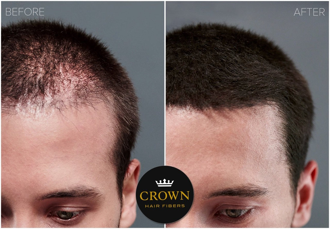 Crown Hair Fibers Best Hair Building Fibers For Bpth And Women Dark Brown
