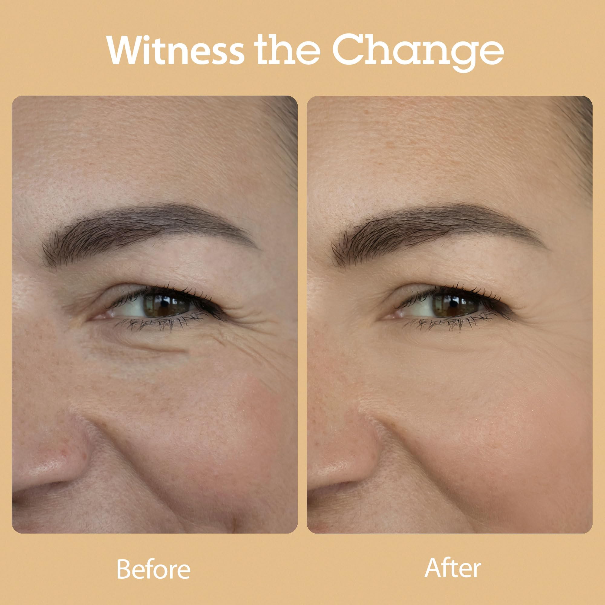 BLITHE Vital Treatment 8 Nourishing Beans 150ml