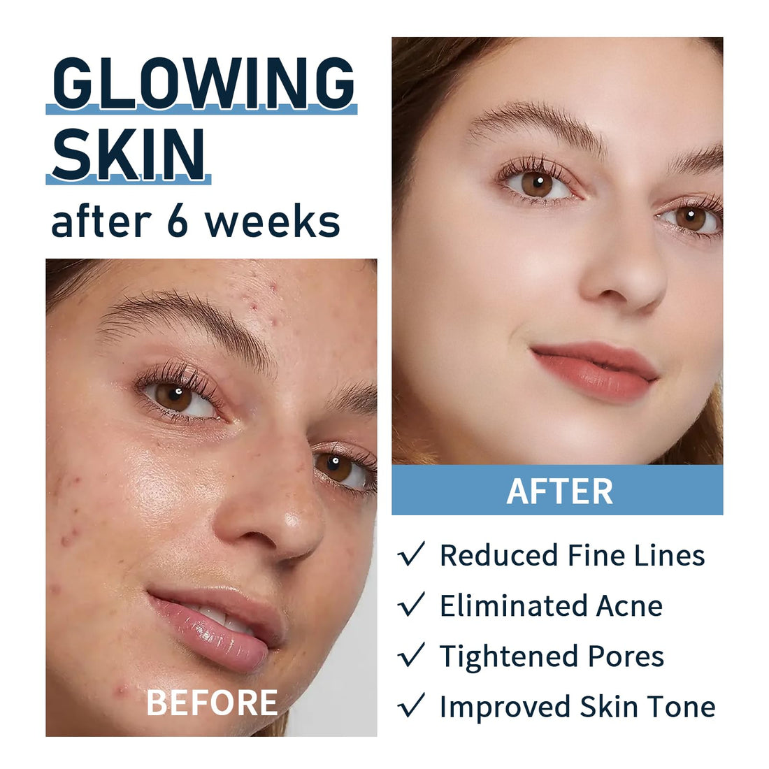 Argireline Serum with Hyaluronic Acid for Fine Lines, 30ml Argireline Solution 10 Percent Anti Aging, Anti Wrinkle and Tones Skin, Argireline Peptide for Deep Moisturizing