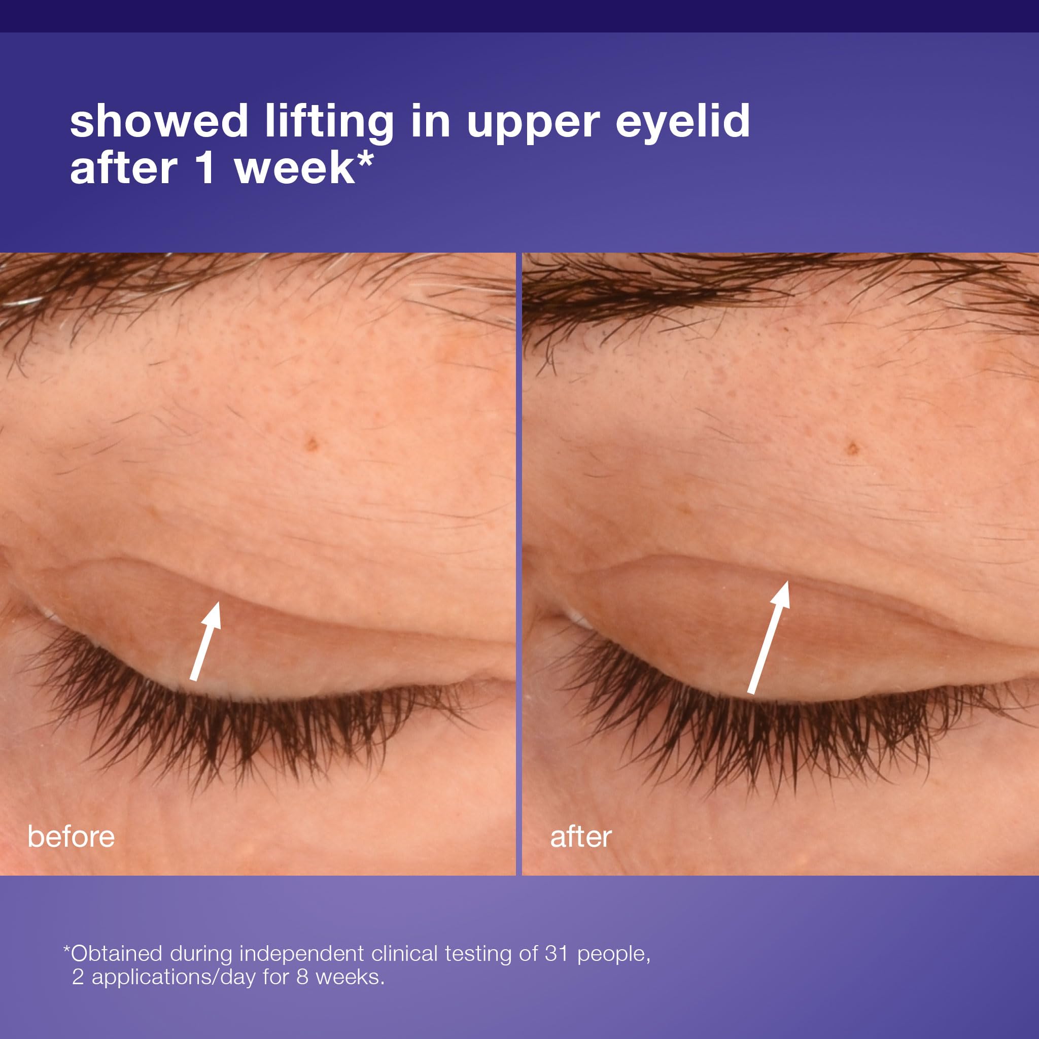 Dermalogica Phyto Nature Lifting Eye Cream, Skin Treatment Serum for Around Eyes - Reduces the Appearance of Fine Lines and Wrinkles