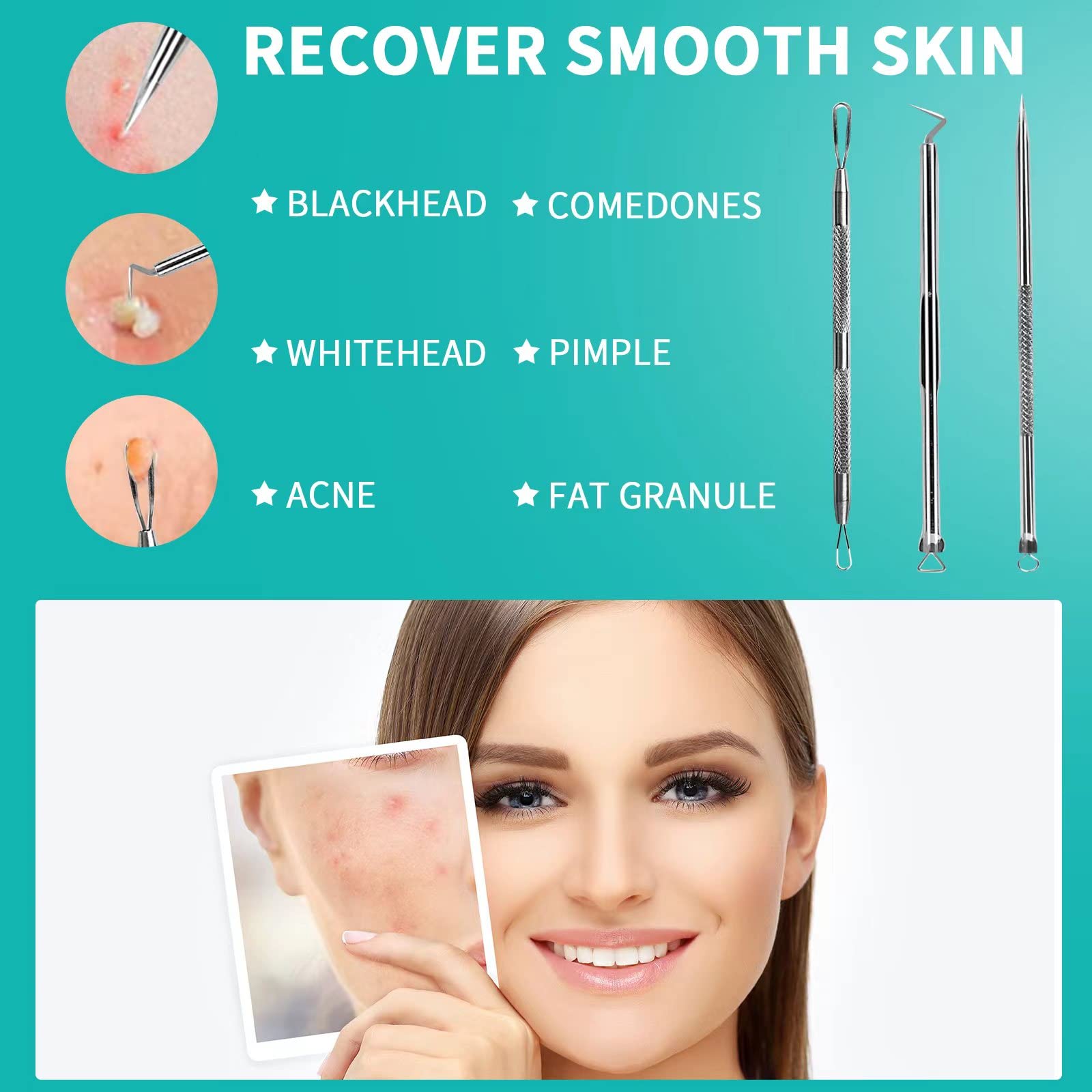 WSYUB Pimple Popper Tool, Stainless Steel Pimple Extractor, WSYUB Blackhead Tweezers, Comedones Extractor Acne Removal Kit for Blemish, Whitehead Popping