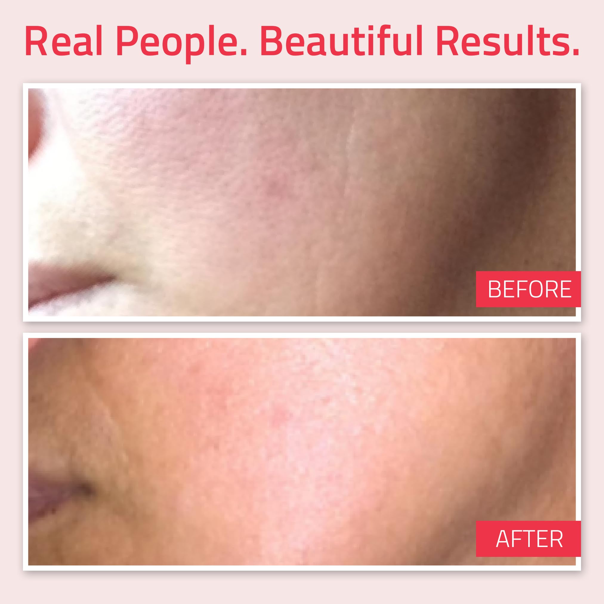 YEOUTH Retinol Cream Moisturizer 2.5% for Face with Hyaluronic Acid, Ginseng and Green Tea (2oz)