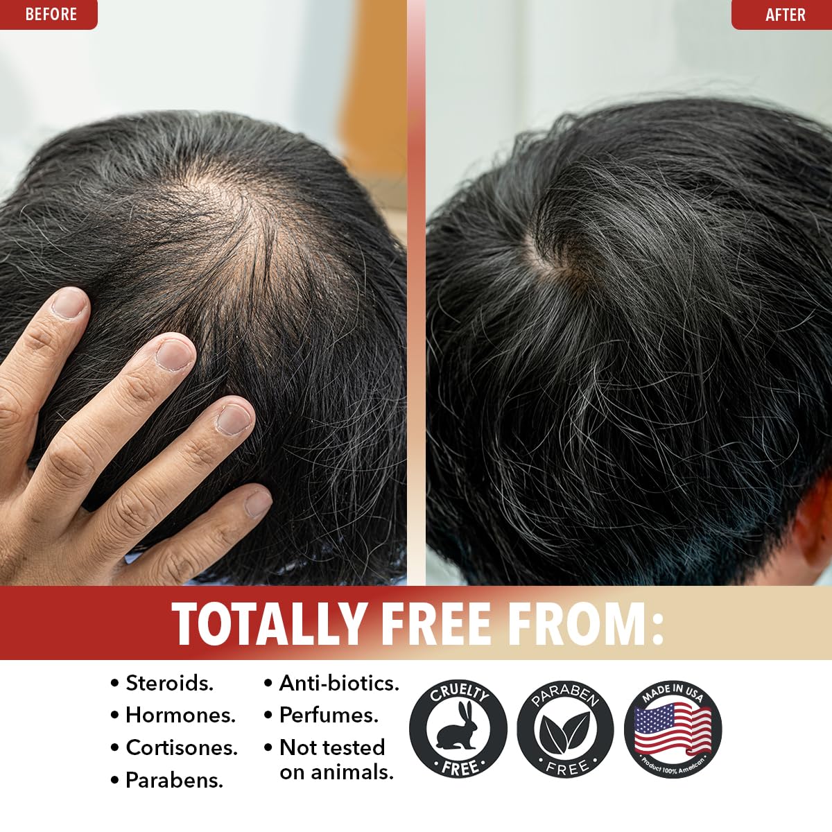 Dr. Robaina 100% Pure Organic Castor Oil – Cold-Pressed for Hair Growth, Deep Skin Hydration, Eyelash & Eyebrow Strengthening – Vegan, Natural Moisturizer, Made in USA