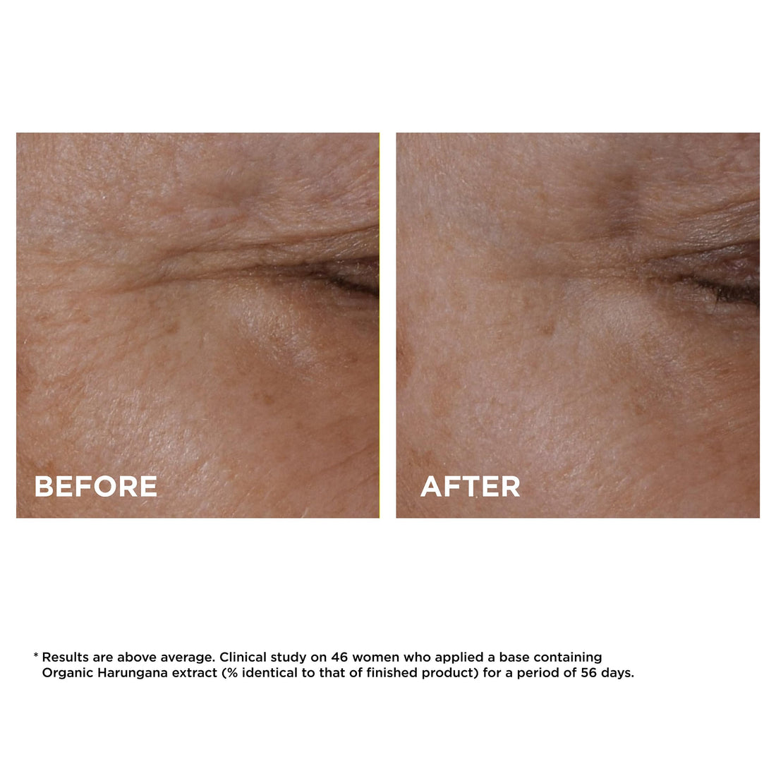 Clarins Total Eye Lift | Anti-Aging Eye Cream | Targets Wrinkles, Crow's Feet, Dark Circles, and Puffiness For a Visible Eye Lift in 60 Seconds Flat*| Ingredients Of 94% Natural Origin