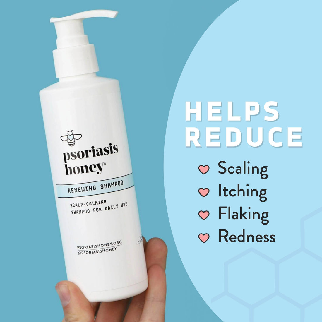 PSORIASIS HONEY Renewing Shampoo - Itchy & Dry Scalp Treatment - Psoriasis Shampoo With Argan Oil for Women & Men - Scalp Psoriasis Relief - Daily Hair Shampoo for Kids (8oz)