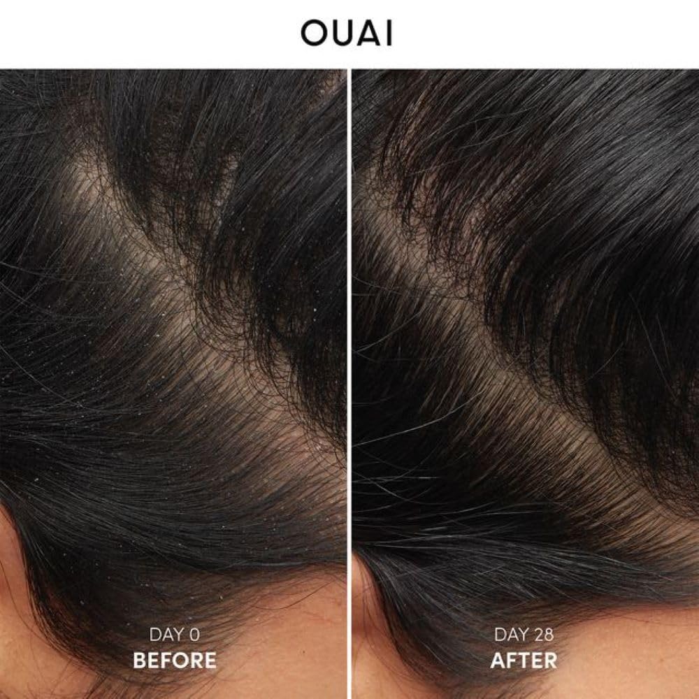 OUAI Anti Dandruff Shampoo - Soothing Salicylic Acid Shampoo for Flaky, Dry and Itchy Scalp - Reduces Itching, Redness and Irritation - Sulfate Free Scalp Care (10 Fl Oz)