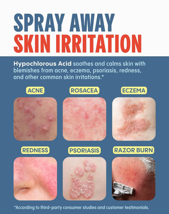 Mighty Mist Premium Hypochlorous Acid Spray for Acne, Eczema, Rosacea | Safe for All Skin Types | Safe for Sensitive Skin | Soothes Irritation and Redness