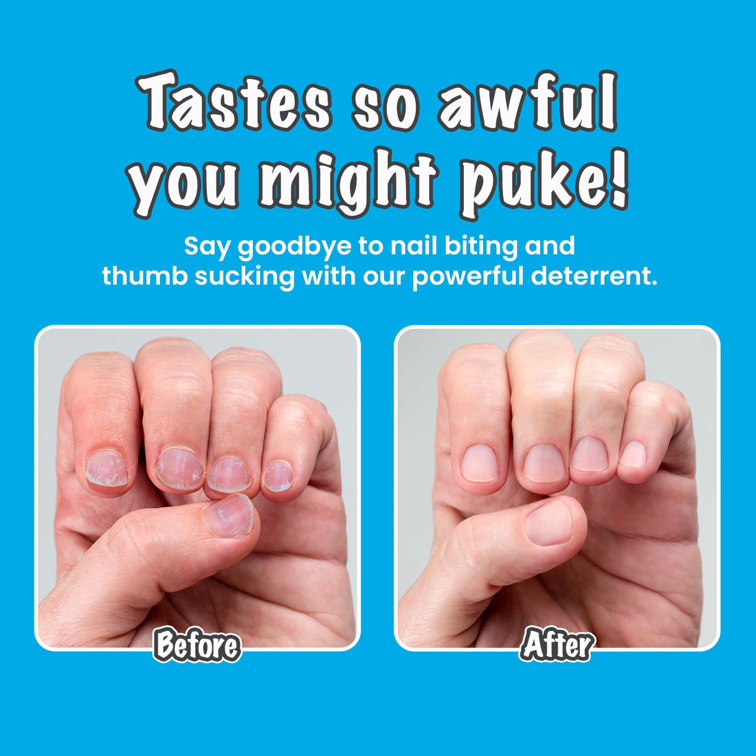 Stop Nail Biting | Nail Biting Deterrent | No Fumes | Not Glossy | Biter Be Goner, 0.3 oz