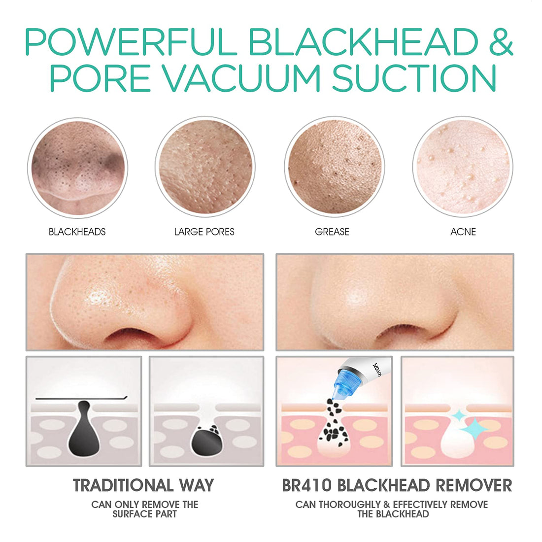VOYOR Blackhead Remover Vacuum Suction Facial Pore Cleaner Electric Acne Comedone Extractor Kit with 4 Suction Head for Women and Men Black Heads Extraction BR410