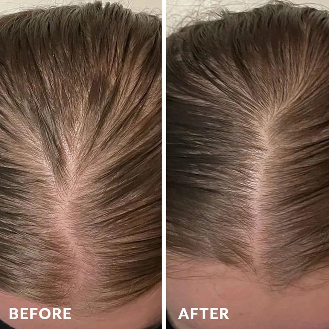 PureNaturis Black Rice Oil Extract Hydrating Conditioner - Anti-Hair Loss, Reduce Hair Fall and Repair for Dry and Damaged Hair, Leaves Hair Soft and Manageable, Captivating Fragrance, 30.43 fl oz