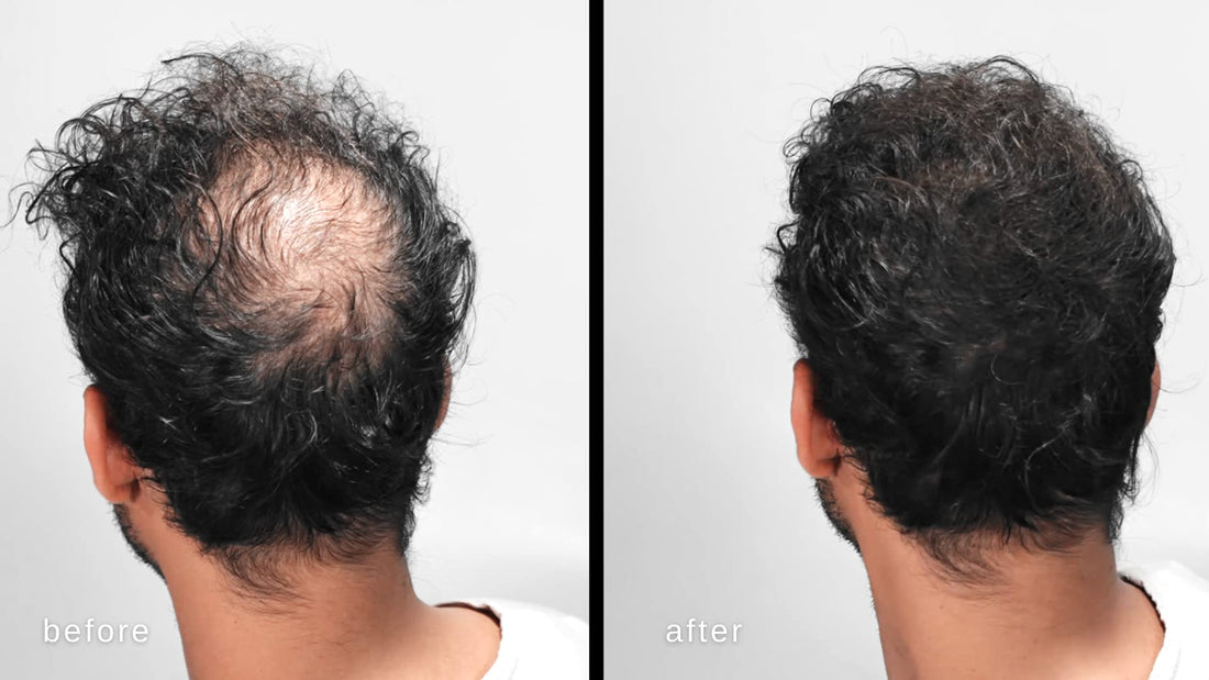 LUXE Hair Thickening Fibers with Natural Keratinâ€“2 Months+ Supply!â€“Confidence in a Jar!â€“Multiple Colors Available (Medium Blond)
