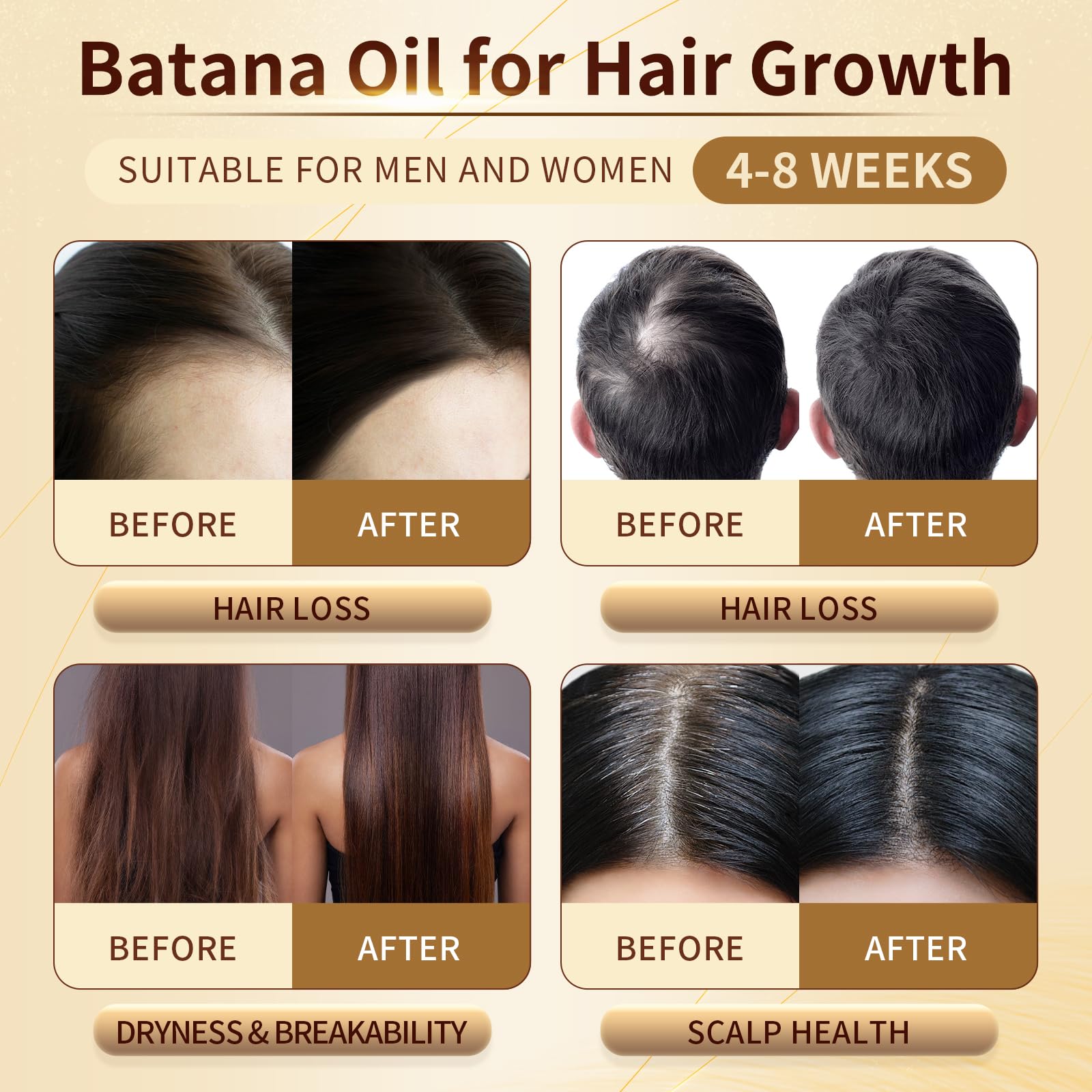 Batana Oil for Hair Growth, 100% Pure & Organic, Cold Pressed Traditional Palm Nut, Unrefined Hair Growth Oil Prevents Hair Loss