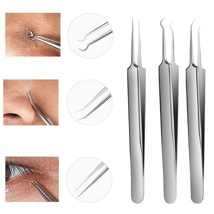 Blackhead Remover Comedone Extractor, 3 in 1 Professional Stainless Skin Zit Acne Blemish Whitehead Popping Removing Surgical Tools Set, Silver