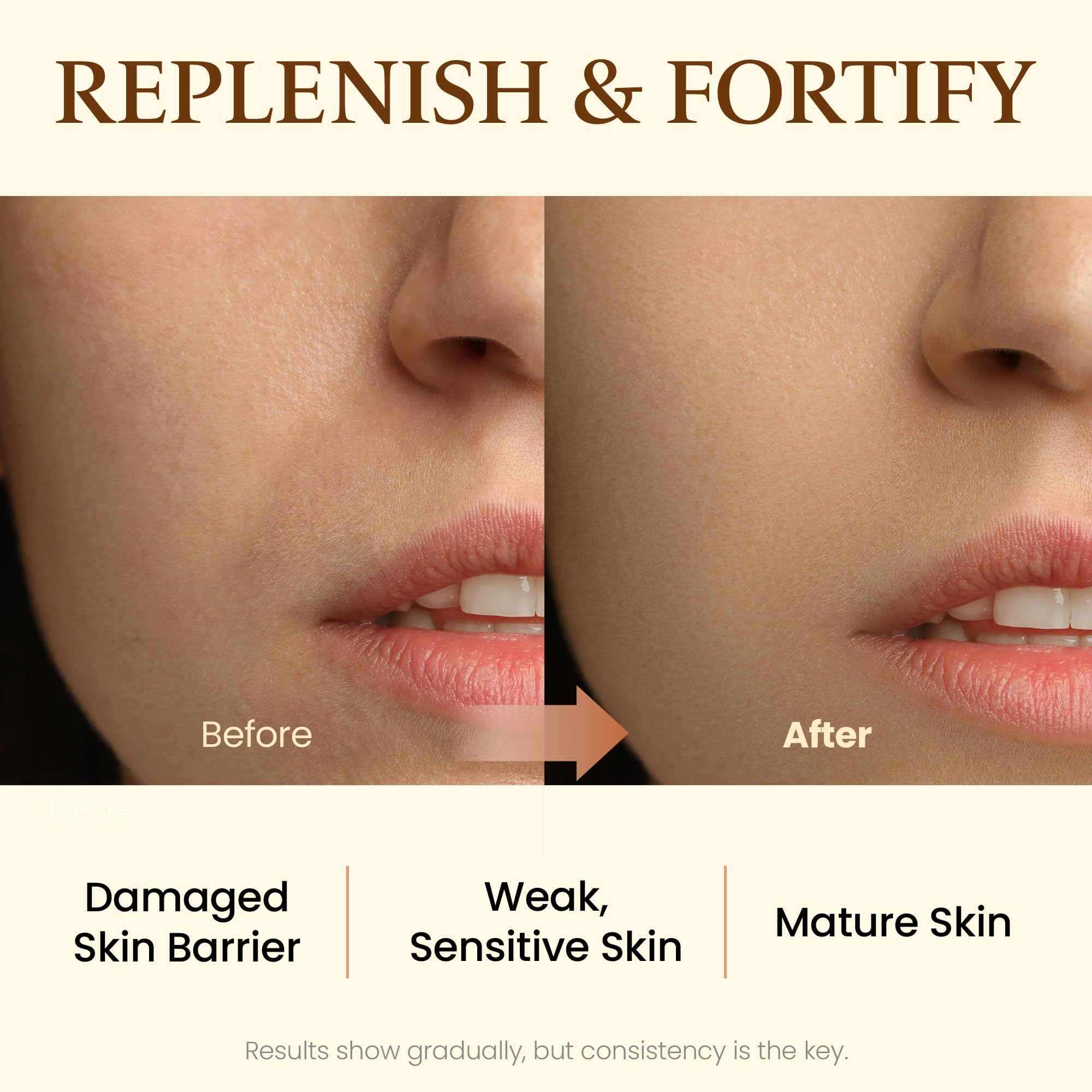 MAXCLINIC Propolis Barrier Ampoule | Deeply Nourishing Honey Ampoule Korean Skin Care & Face Serum for Women & Men | Skin-Fortifying Facial Serum Ampoule | Ceramide Calming Serum (3.38 fl oz)