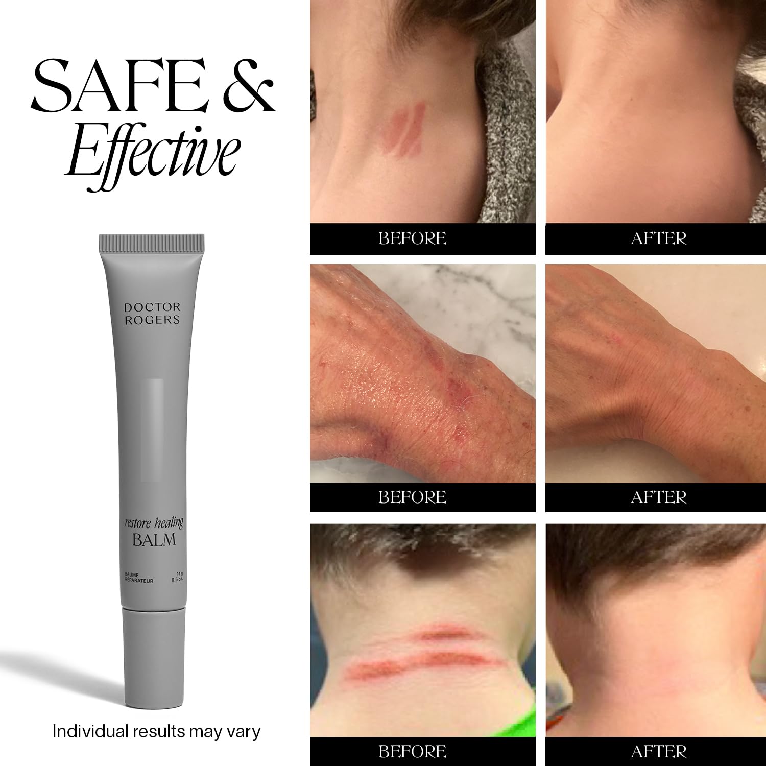 Doctor Rogers Restore Healing Balm. Multi-Purpose Healing Ointment & Moisturizing Eczema Relief Gel. Protects & Soothes Injured, Sensitive & Dry Skin 0.5 Ounce Tube (14 gram)