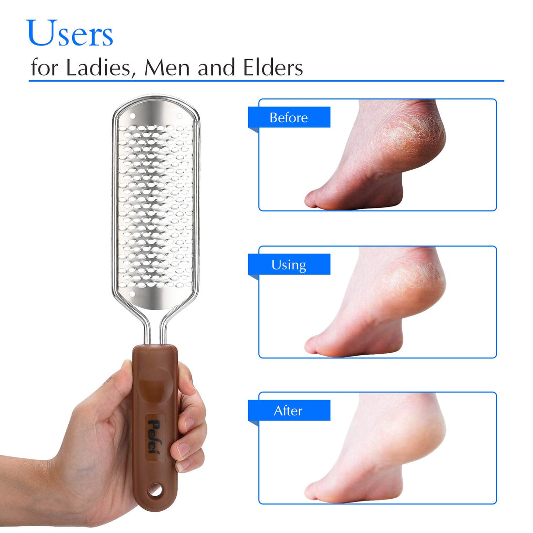 Foot File Callus Remover, Pefei Colossal Professional Stainless Steel Detachable Foot Scrubber, Hard Skin Removers Pedicure Rasp for Wet and Dry Feet