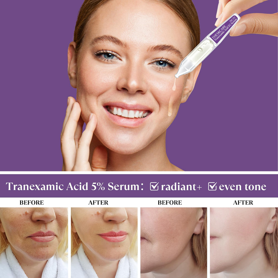 THESKCARE 5% Tranexamic Acid Serum Ampoule for Face with Niacinamide,Kojic Acid & Alpha Arbutin,Skin Glowing Serum for Dark Spots,Even Out Skin Tone,30 Ampoules