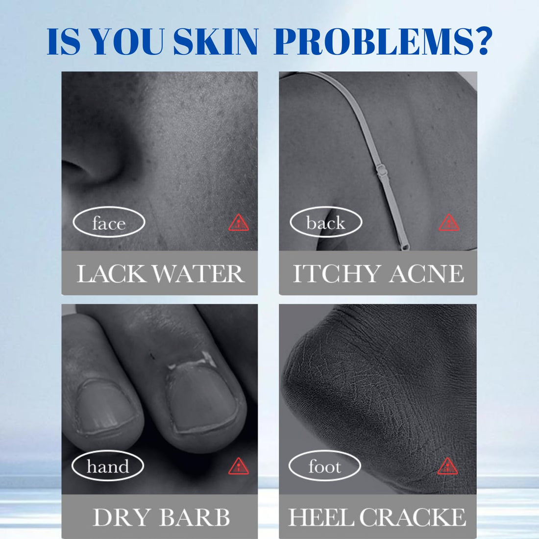 Urea Body Cream 42% - 2pcs Body Lotion for Dry Skin - Salicylic Acid Lotion for Extremely Dry Skin - Urea Cream for Feet - Body Moisturizer Cream - Moisturizes & Softens,Exfoliates Dead Skin