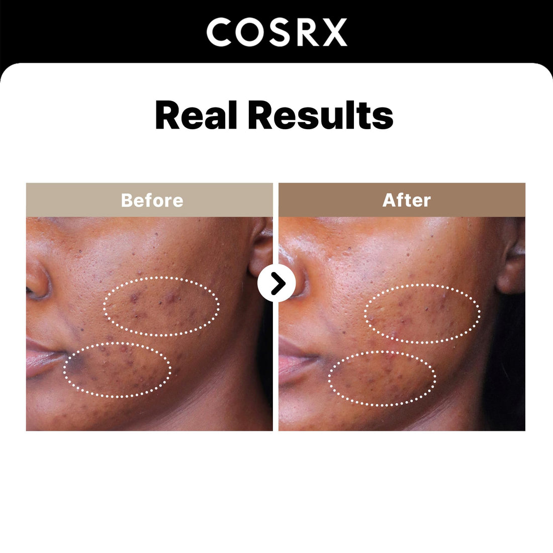 COSRX 2% Alpha Arbutin Discoloration Care Face Serum with Niacinamide, Glutathione & Tranexamic Acid, 1.7 fl oz – Serum for Face, Korean Skin Care