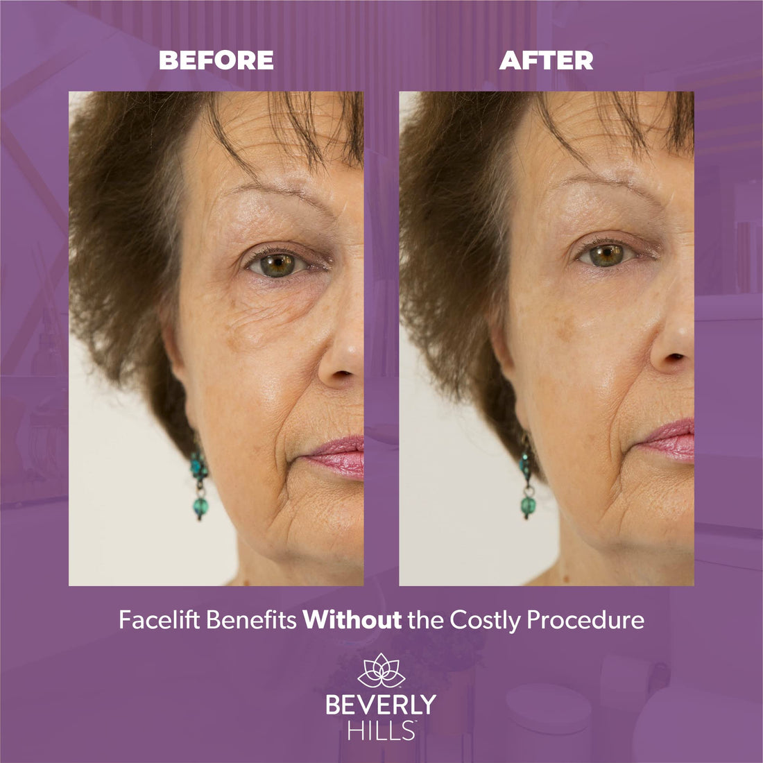 Beverly Hills Instant Facelift & Eye Tuck 30ml
