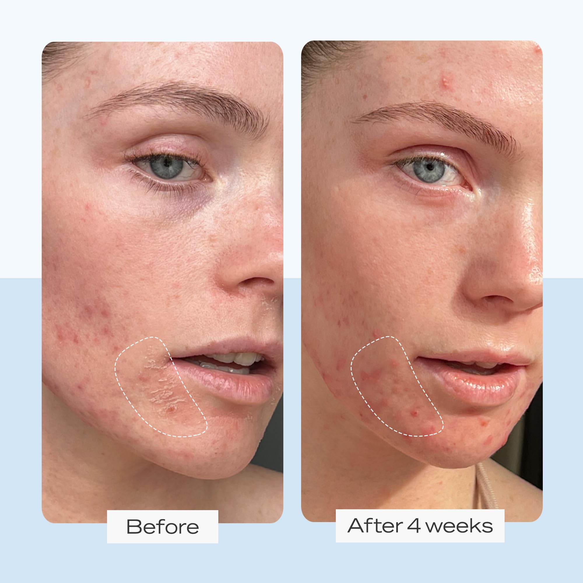 First Aid Beauty Ultra Repair Cream - 12.0 oz