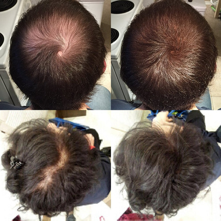 Light Brown : Nor1 Hair Fibers [BEST VALUE] - Light Brown 25g (90 day supply)