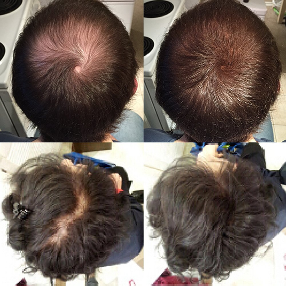 Auburn : Nor1 Hair Fibers [BEST VALUE] - Auburn 25g (90 day supply)