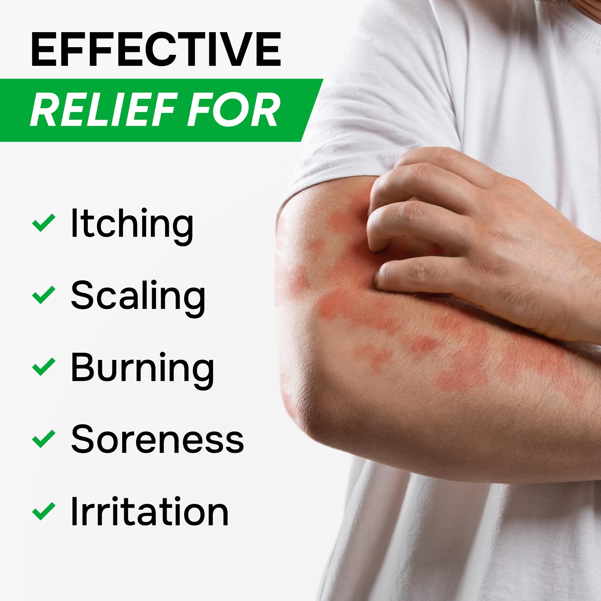 Antifungal Cream for Athlete's Foot, Ringworm & Jock Itch - Clotrimazole 1% Made in USA - Extra Strength Ring Worm, Jock Itch Cream, Anti Fungal Athletes Foot Treatment for Humans Skin Fungus - 2 oz