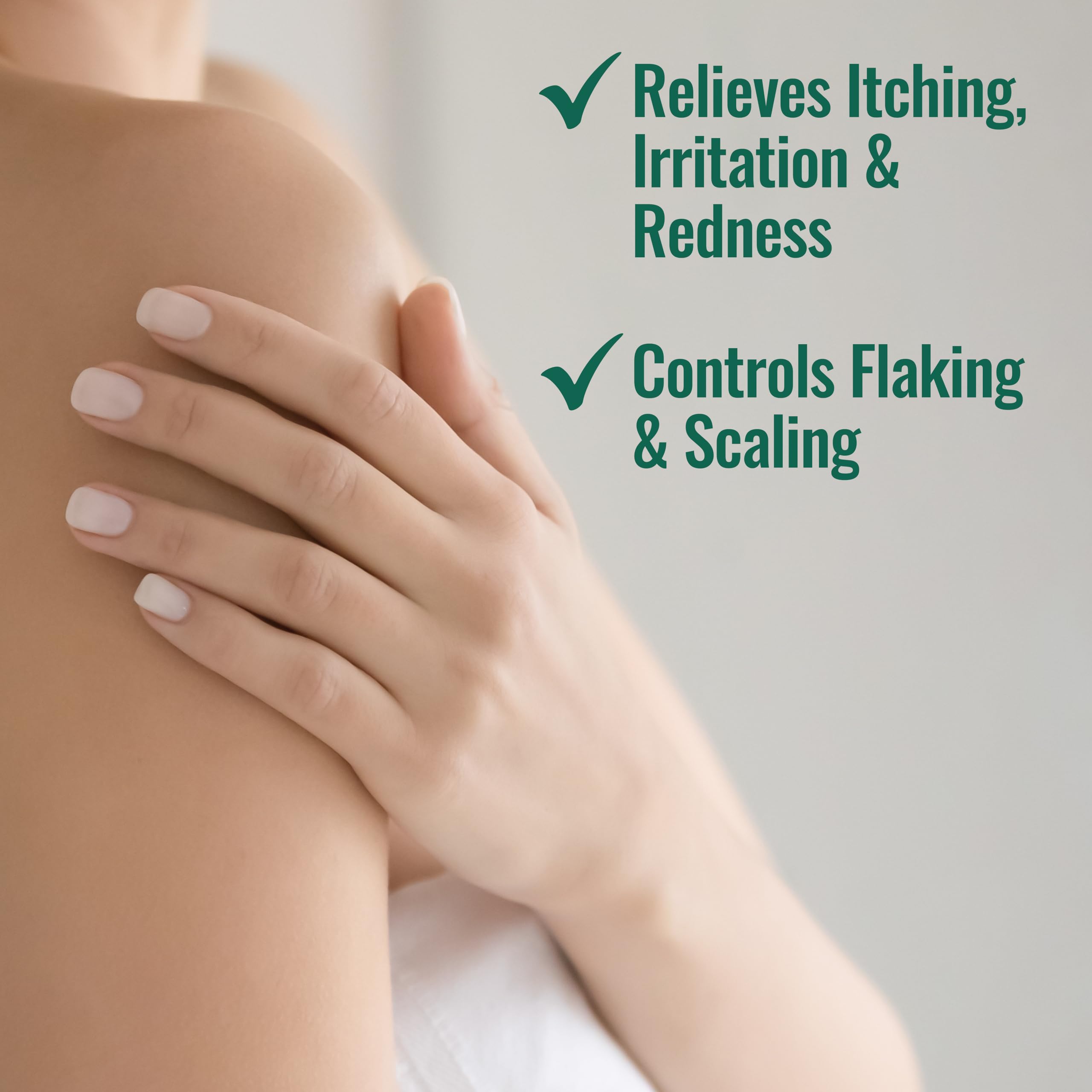 Nizoral Psoriasis Relief Cream- Relieves Itching, Irritation & Redness and Controls Flaking and Scaling with Maximum Strength Medicine (Salicylic Acid 3%), 4 Fl Oz