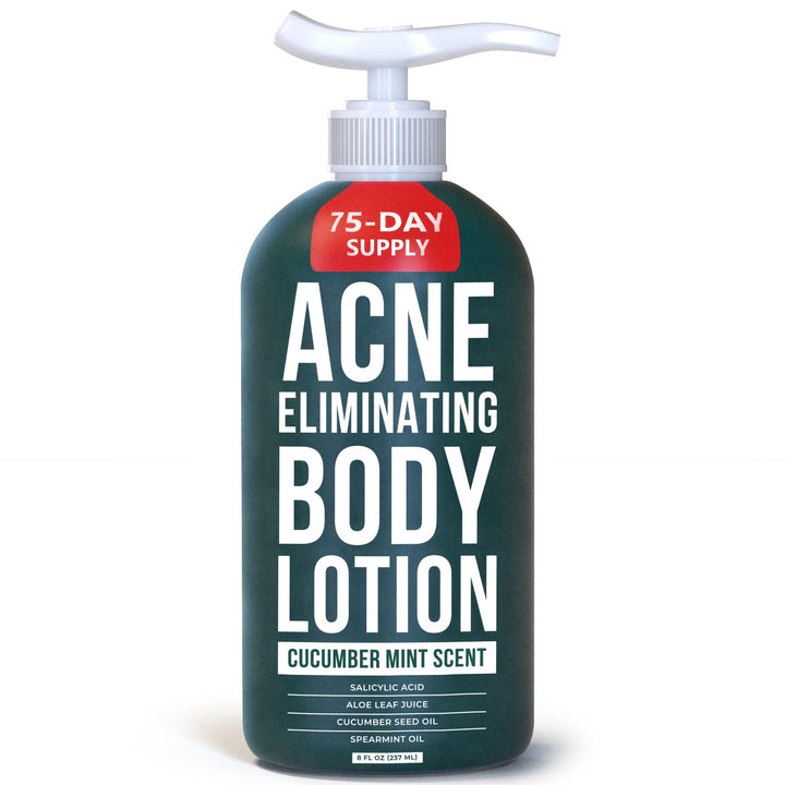TreeActiv Acne Eliminating Body Lotion 8 fl oz | Clears Body, Back, Butt and Shoulder Acne | Anti-Acne Moisturizer | Prevents Future Breakouts | Cucumber Mint Scent