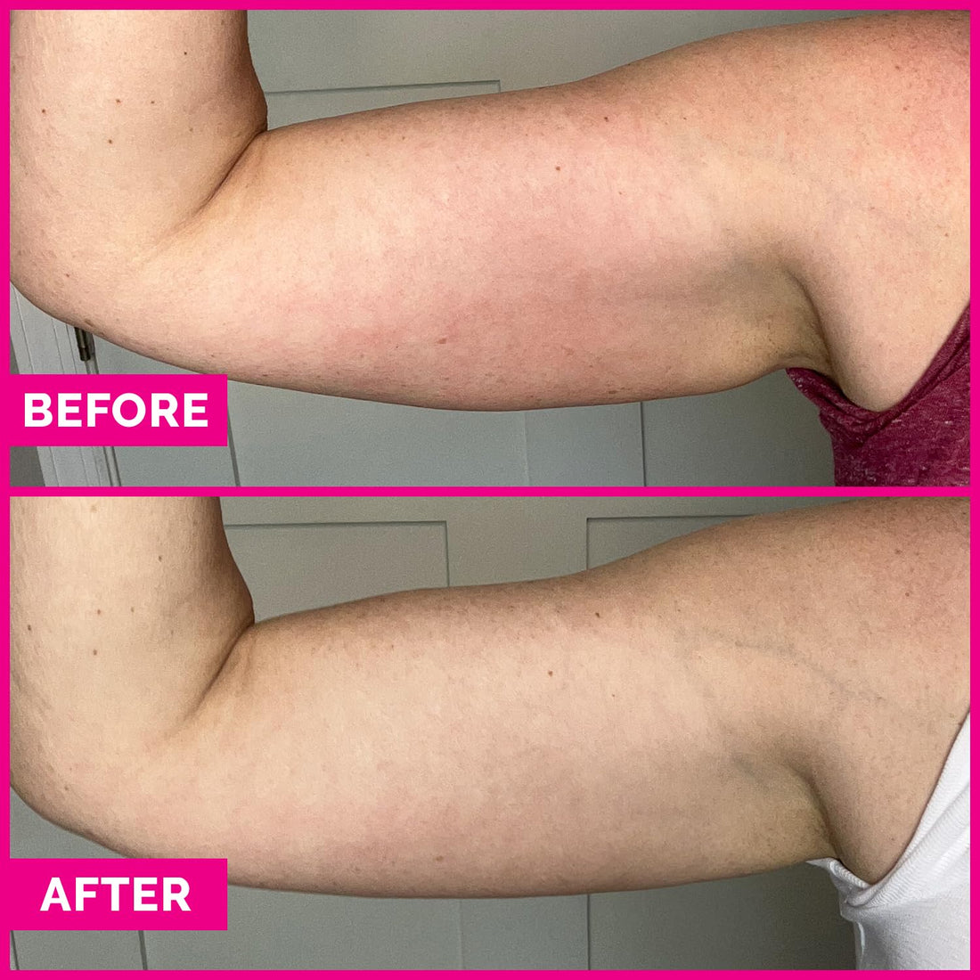 Arm Sleek Firming Serum For Upper Arms - Skin Toning And Tightening Treatment With Actigym + Caffeine + Peptides - 4 Oz.
