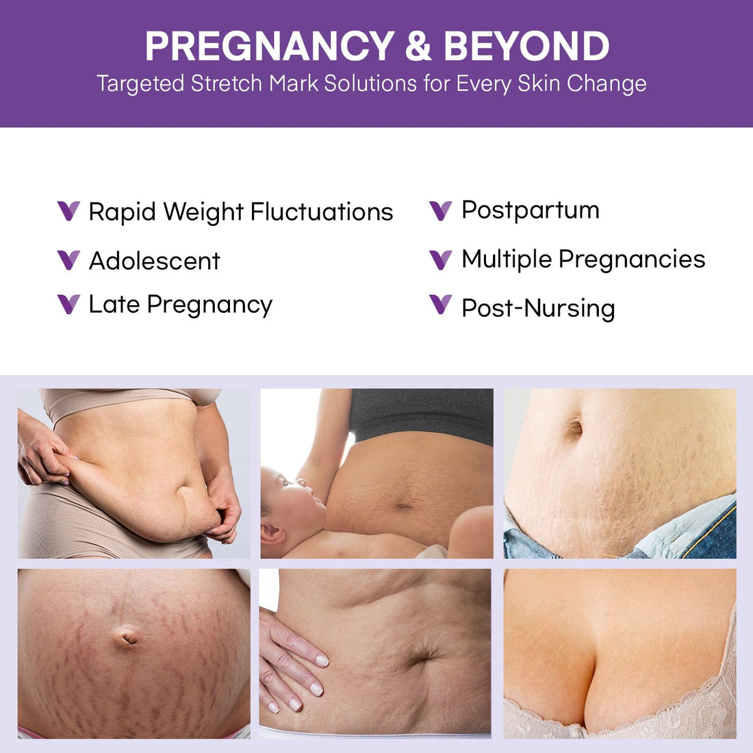 Stretch Mark Cream for Pregnant Women: Stretch Mark Treatment for Pregnancy - Belly Butter For Pregnant Women - Massage Lotion To Prevent And Repair Maternity Stretch Marks Scar - 4 Oz