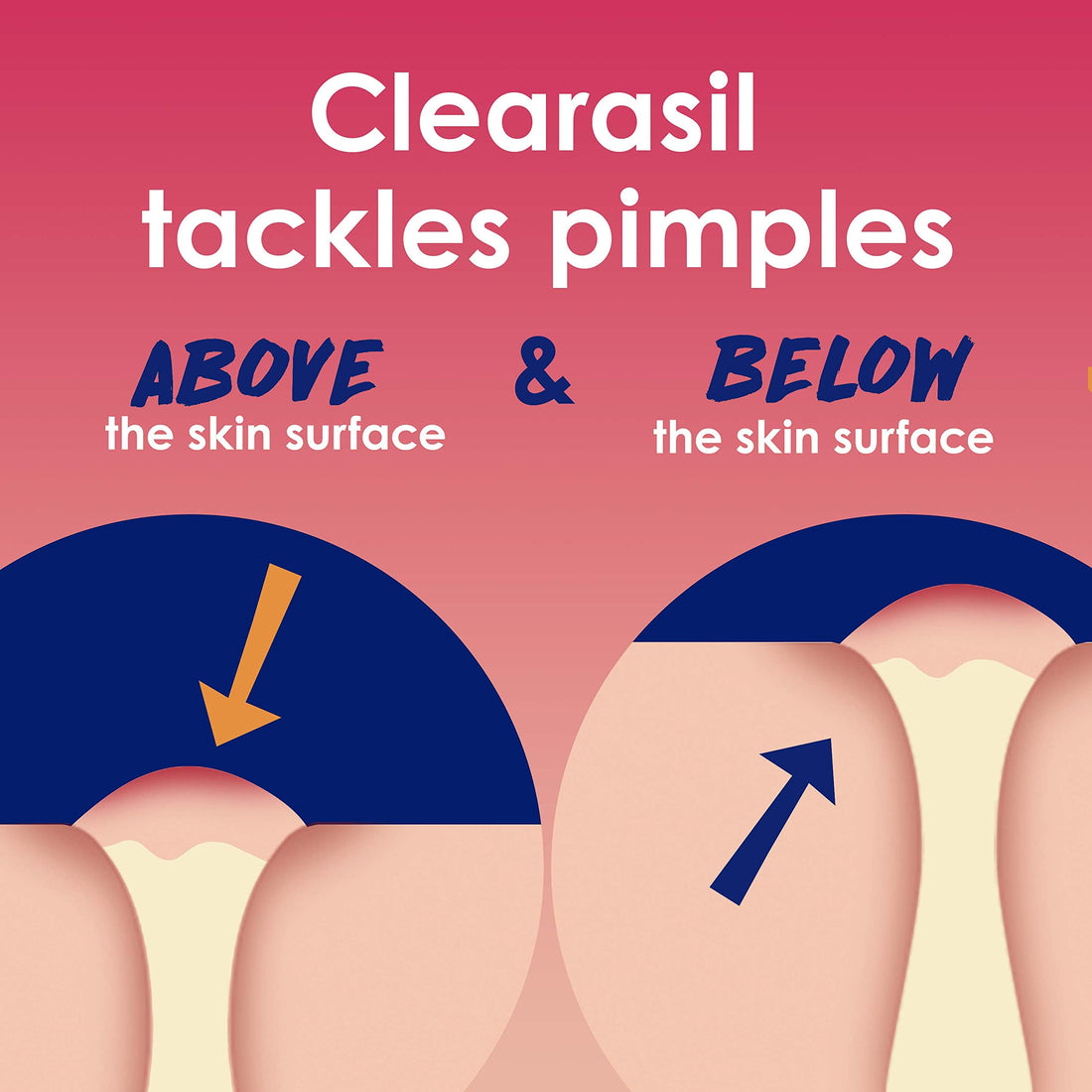 Clearasil Rapid Rescue - Deep Treatment Pads 6/90 ct.